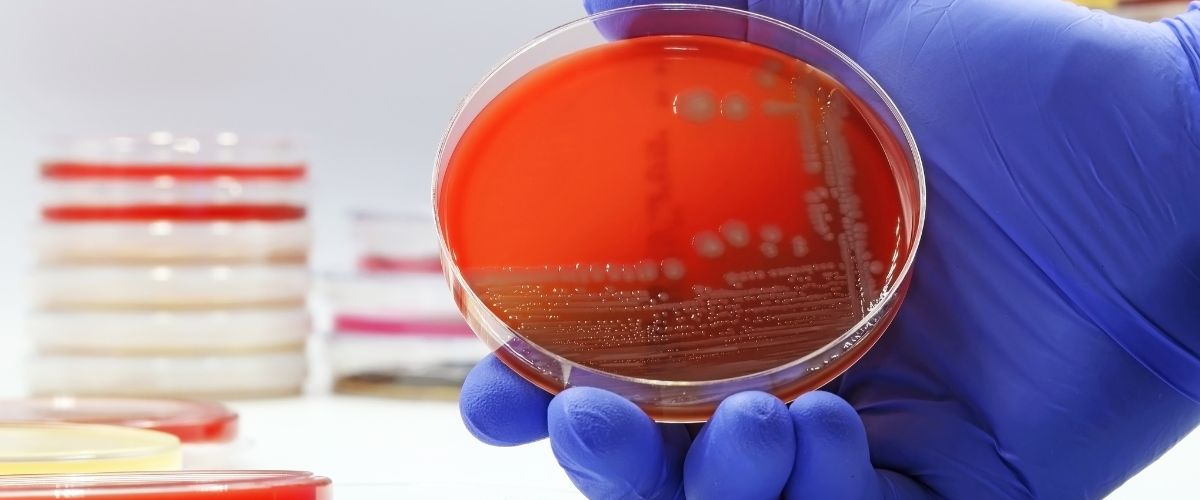 E. coli en Restaurantes: Evita Intoxicaciones